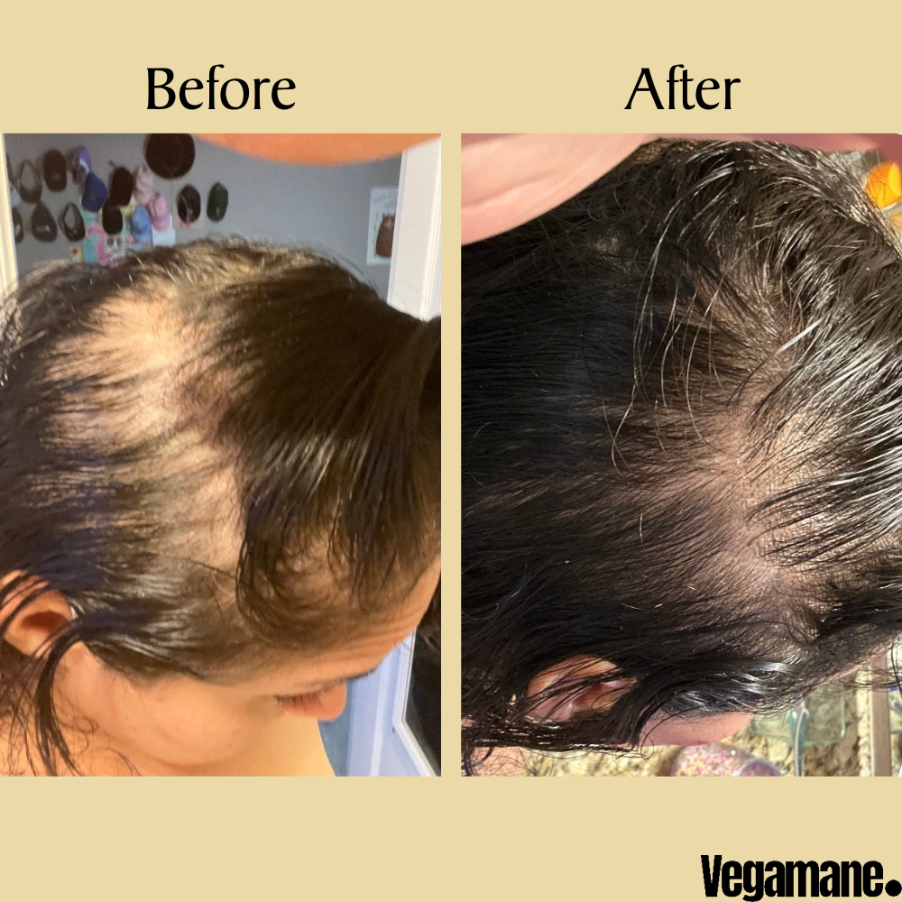 Vegamane Natural Hair Growth Oil