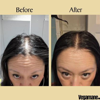 Vegamane Natural Hair Growth Oil